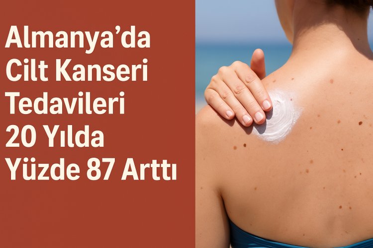 Almanya’da Cilt Kanseri Tedavileri 20 Yılda Yüzde 87 Arttı
